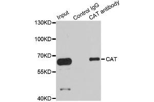 Immunoprecipitation analysis of 100ug extracts of HepG2 cells using 3ug CAT antibody. (Catalase antibody)