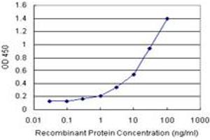 Sandwich ELISA detection sensitivity ranging from 0. (TARBP2 (Human) Matched Antibody Pair)
