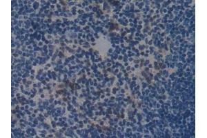 Immunohistochemistry (IHC) image for anti-Collagen, Type I, alpha 2 (COL1A2) (AA 1109-1372) antibody (ABIN7442342)