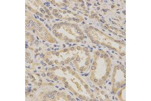 Immunohistochemistry of paraffin-embedded human kidney using BCL2L1 antibody at dilution of 1:200 (x400 lens) (BCL2L1 antibody)