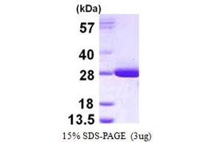 Image no. 1 for Glutathione S-Transferase theta 2 (GSTT2) protein (His tag) (ABIN1098234)