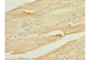 Immunohistochemistry of paraffin-embedded human skeletal muscle tissue using ABIN7146597 at dilution of 1:100 (CALU antibody  (AA 20-315))