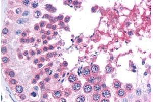 Human Testis: Formalin-Fixed, Paraffin-Embedded (FFPE) (SMARCA4 antibody  (C-Term))