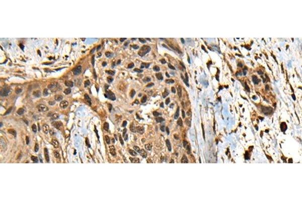 CCDC113 antibody
