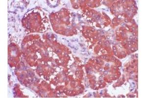 Immunohistochemistry (IHC) image for anti-Trefoil Factor 1 (TFF1) (AA 57-84), (C-Term) antibody (ABIN781662) (TFF1 antibody  (C-Term))
