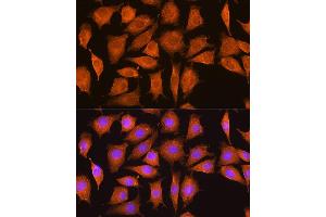 Immunofluorescence analysis of L929 cells using NCSTN Rabbit pAb (ABIN7268905) at dilution of 1:100. (Nicastrin antibody  (AA 429-669))