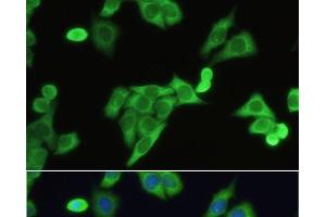 Immunofluorescence analysis of HeLa cells using SLC2A9 Polyclonal Antibody at dilution of 1:100. (SLC2A9 antibody)