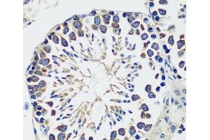 Immunohistochemistry of paraffin-embedded Mouse testis using CCDC124 Polyclonal Antibody at dilution of 1:100 (40x lens). (CCDC124 antibody)