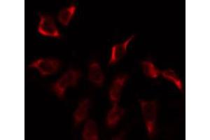 ABIN6274915 staining Hela by IF/ICC. (GUSBP2 antibody)