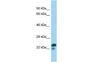 WB Suggested Anti-SPIN2A Antibody Titration: 1. (SPIN2A antibody  (N-Term))
