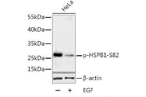Western blot analysis of extracts of HeLa cells using Phospho-HSPB1(S82) Polyclonal Antibody at dilution of 1:1000. (HSP27 antibody  (pSer82))