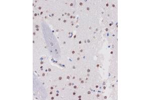 Immunohistochemistry of paraffin-embedded Mouse brain using B Rabbit pAb (ABIN7265702) at dilution of 1:100 (40x lens). (ARID1B antibody  (AA 400-650))