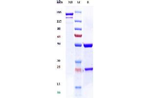 Anti-TSHR Reference Antibody (K1-70) on SDS-PAGE under reducing (R) condition.