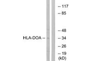 Western blot analysis of extracts from COLO cells, using HLA-DOA Antibody. (HLA-DOA antibody  (AA 71-120))