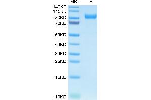 Human Kremen-1 on Tris-Bis PAGE under reduced condition. (KREMEN1 Protein (AA 21-392) (Fc Tag))