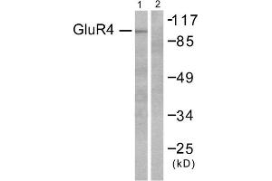 Western blot analysis of extracts from 293 cells, untreated or treated with Forskolin (40nM, 30mins), using GluR4 antibody (ABIN5976411). (Metabotropic Glutamate Receptor 4 antibody  (C-Term))
