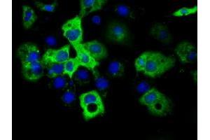 Immunofluorescence (IF) image for anti-Insulin-Like Growth Factor 2 mRNA Binding Protein 2 (IGF2BP2) antibody (ABIN1498823) (IGF2BP2 antibody)