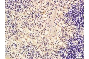 Formalin-fixed and paraffin embedded human spleen labeled with Rabbit Anti-eIF4ENIF1 Polyclonal Antibody, Unconjugated (ABIN2173808) at 1:200 followed by conjugation to the secondary antibody and DAB staining