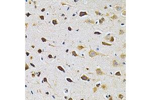 Immunohistochemistry of paraffin-embedded rat brain using ADRBK1 Antibody. (GRK2 antibody  (AA 440-689))