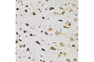 Immunohistochemistry of paraffin-embedded rat brain using ADRBK1 Antibody. (GRK2 antibody  (AA 440-689))