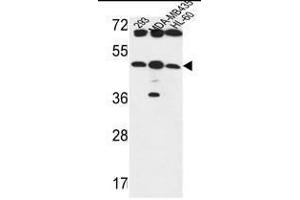B3GNT5 Antibody (Center) western blot analysis in 293,MDA-MB435,HL-60 cell line lysates (35µg/lane). (B3GNT5 antibody  (Middle Region))
