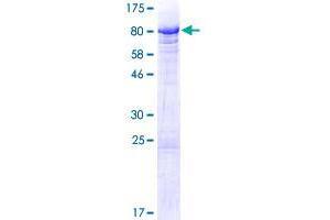 BANP Protein (AA 1-469) (GST tag)