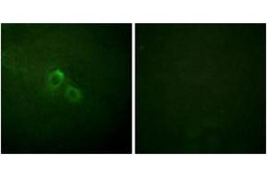 Immunofluorescence analysis of HuvEc cells, using Kv1. (KCNA3 antibody  (AA 101-150))