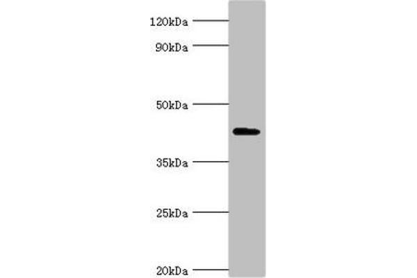 AIPL1 抗体  (AA 1-384)