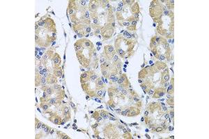 Immunohistochemistry of paraffin-embedded human gastric using BAG5 antibody at dilution of 1:100 (x40 lens). (BAG5 antibody)