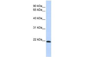 Claudin 7 antibody used at 1 ug/ml to detect target protein. (Claudin 7 antibody  (Middle Region))