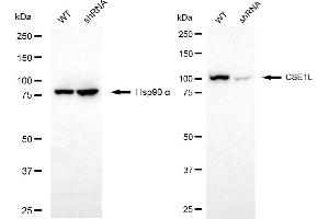Western blotting analysis using CSE1L antibody (ABIN7798171).