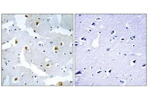 Immunohistochemistry analysis of paraffin-embedded human brain tissue using FMN2 antibody. (Formin 2 antibody  (C-Term))