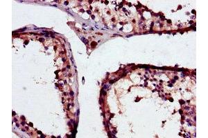 Immunohistochemistry of paraffin-embedded human testis tissue using ABIN7154107 at dilution of 1:100 (GSTM3 antibody  (AA 1-225))