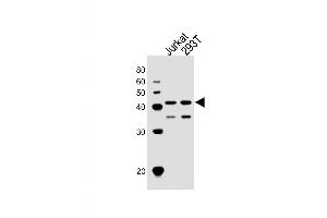 Western Blot at 1:1000 dilution Lane 1: Jurkat whole cell lysates Lane 2: 293T whole cell lysates Lysates/proteins at 20 ug per lane. (ETS1 antibody  (N-Term))