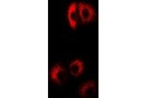 Immunofluorescent analysis of EIF4B staining in Hela cells. (EIF4B antibody)