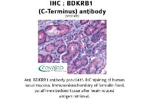 Image no. 1 for anti-Bradykinin Receptor B1 (BDKRB1) (C-Term) antibody (ABIN2852366) (BDKRB1 antibody  (C-Term))