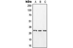 Western blot analysis of Kallikrein 11 expression in HEK293T (A), HepG2 (B), rat brain (C) whole cell lysates. (Kallikrein 11 antibody  (Center))