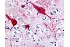 Immunohistochemistry (IHC) image for anti-Solute Carrier Family 5 (Sodium/glucose Cotransporter), Member 9 (SLC5A9) (C-Term) antibody (ABIN2469312) (SLC5A9 antibody  (C-Term))