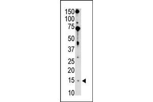 Image no. 1 for anti-BCL2-Interacting Killer (Apoptosis-Inducing) (BIK) (N-Term) antibody (ABIN356832) (BIK antibody  (N-Term))