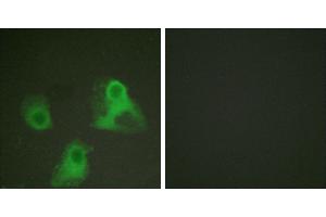 P-peptide - +Immunofluorescence analysis of HeLa cells, using ADD1 (phospho-Ser726) antibody (#A0002). (alpha Adducin antibody  (pSer726))