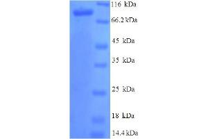 SDS-PAGE (SDS) image for Protein S (PROS) (AA 42-676) protein (His-SUMO Tag) (ABIN4976175)