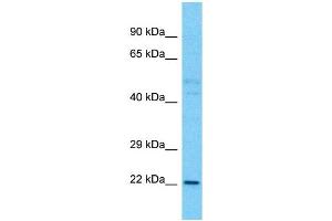 Western Blotting (WB) image for anti-TLC Domain Containing 1 (TLCD1) (C-Term) antibody (ABIN2791939) (TLCD1 antibody  (C-Term))