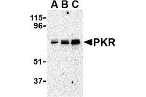 Western Blotting (WB) image for anti-Eukaryotic Translation Initiation Factor 2-alpha Kinase 2 (EIF2AK2) (C-Term) antibody (ABIN1030589) (EIF2AK2 antibody  (C-Term))