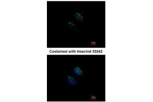 ICC/IF Image Immunofluorescence analysis of methanol-fixed HeLa, using GnT-III, antibody at 1:200 dilution. (MGAT3 antibody)