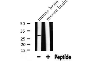 Western Blotting (WB) image for anti-Carbonic Anhydrase II (CA2) (C-Term) antibody (ABIN6260379)