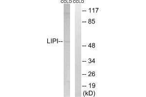 Western blot analysis of extracts from COLO cells, using LIPI antibody. (Lipase I antibody  (Internal Region))