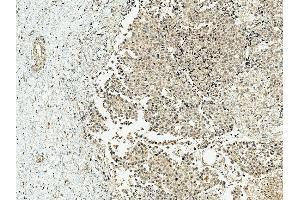 Immunohistochemistry analysis using Rabbit Anti-CBP Polyclonal Antibody (ABIN5667459). (CBP antibody  (AA 2100-2200) (FITC))