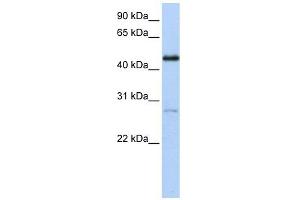 NR2F1 antibody used at 1 ug/ml to detect target protein. (NR2F1 antibody  (C-Term))