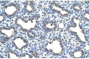 Human Lung (UBE2D2 antibody  (Middle Region))