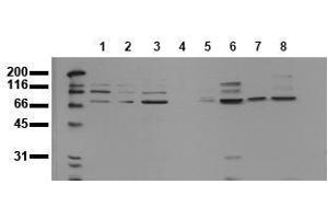 Western Blotting (WB) image for anti-Ankyrin Repeat Domain 6 (ANKRD6) antibody (ABIN126755)